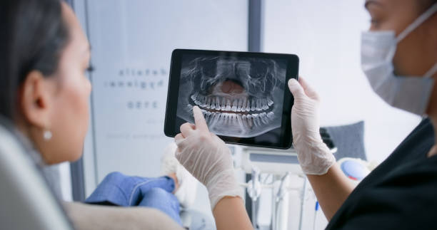 Licensed Tooth Extraction service in Califon, NJ - Smile Center Dentistry